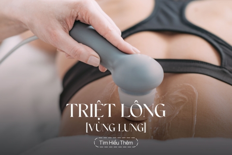 Triệt lông vùng lưng